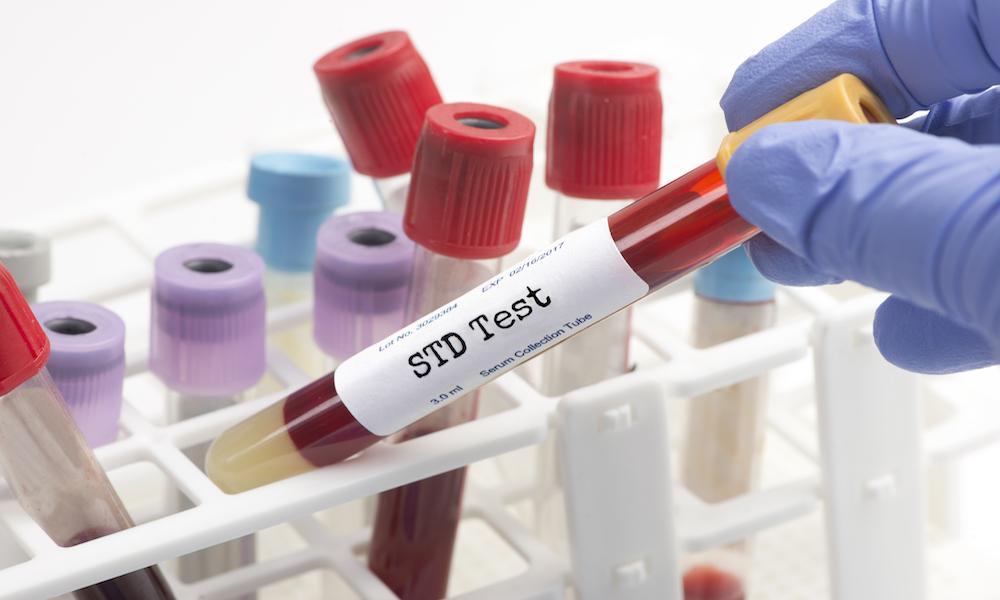 STD Screening