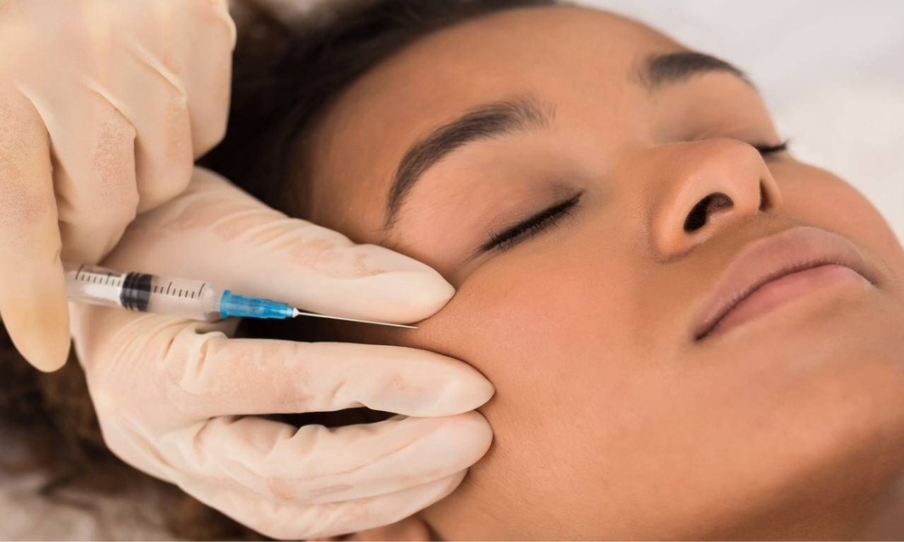 A Simple Guide to Ellanse and Its Natural Skin-Revitalizing Effects