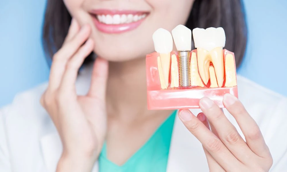 What to Consider When Comparing All-on-4 Treatment Costs