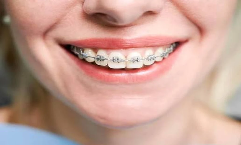Why Preventive Dental Screenings Should Be Routine